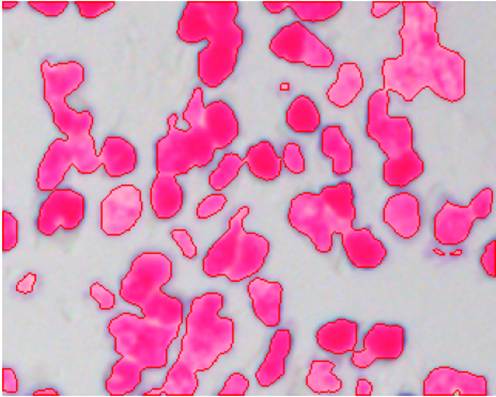 人工智能实验平台(图20) 细胞图像分割
